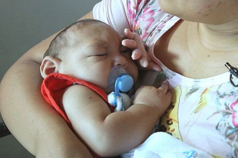 EUA confirmam relação entre Zika e microcefalia
