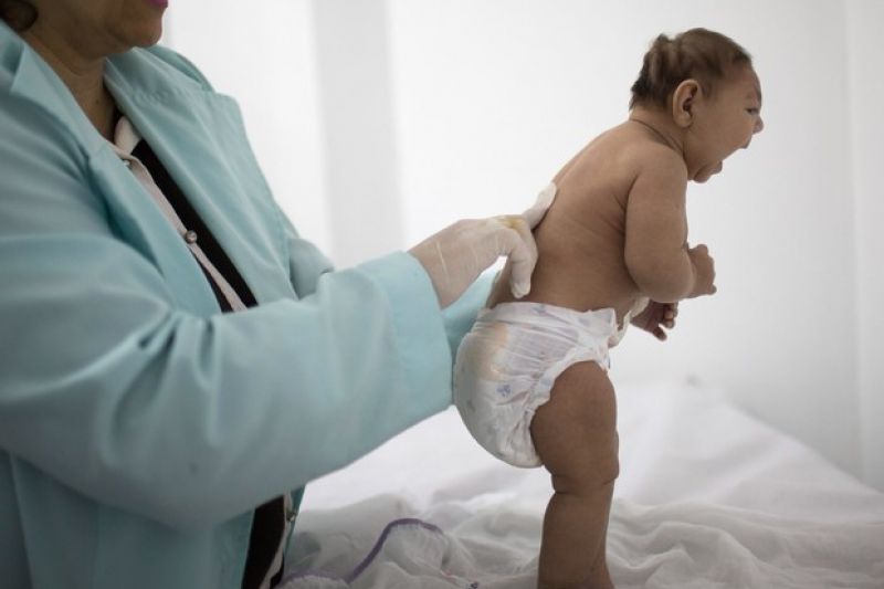 Alagoas tem 73 casos confirmados de microcefalia e outros 61 são investigados