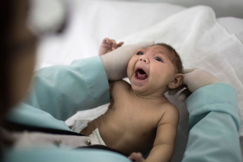 Sobe para 75 o número de casos de microcefalia em Alagoas, informa Ministério da Saúde