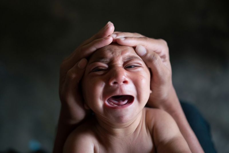 Santana do Ipanema lidera número de casos de microcefalia confirmados no Sertão em 2016