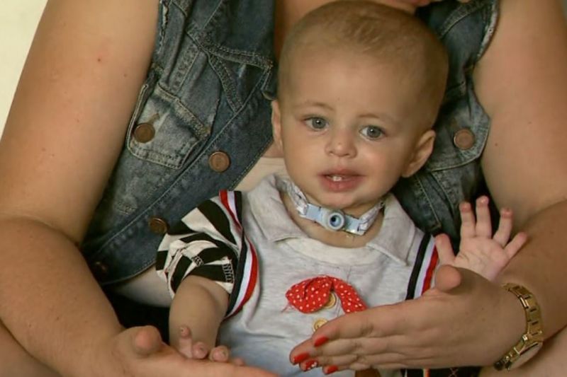 Bebê de um ano tem pé e pontas dos dedos amputados após ser internado com pneumonia