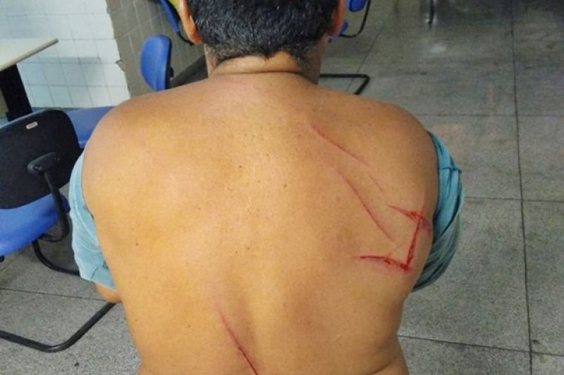 Pai e filho são suspeitos de agredir vizinho com golpes de facão e cabo de enxada