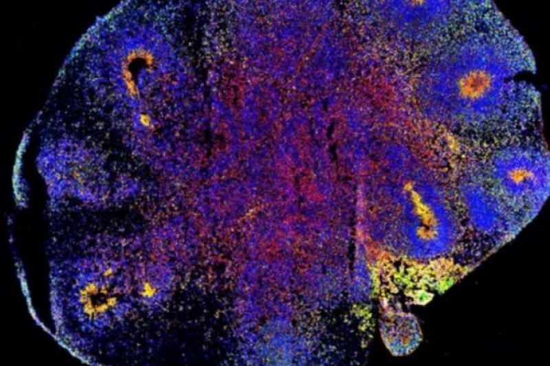 Criados em laboratório por brasileiros, minicérebros ajudam a entender o cérebro humano