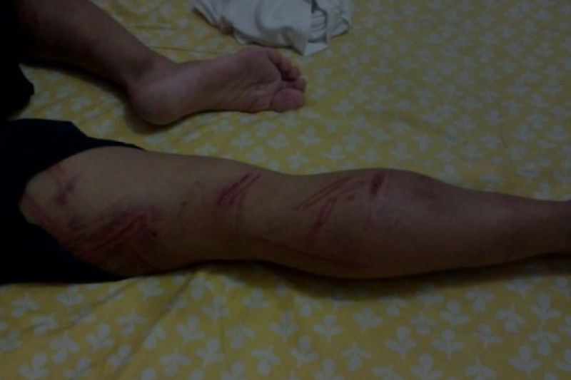 Laudo comprova que soldado foi torturado durante trote em quartel do Exército