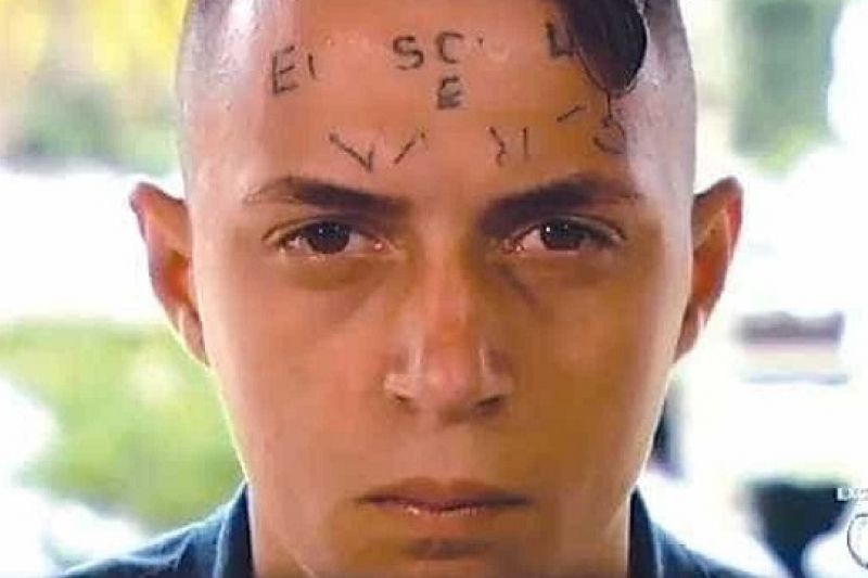 Jovem tatuado na testa deixa clínica em SP após 16 meses internado