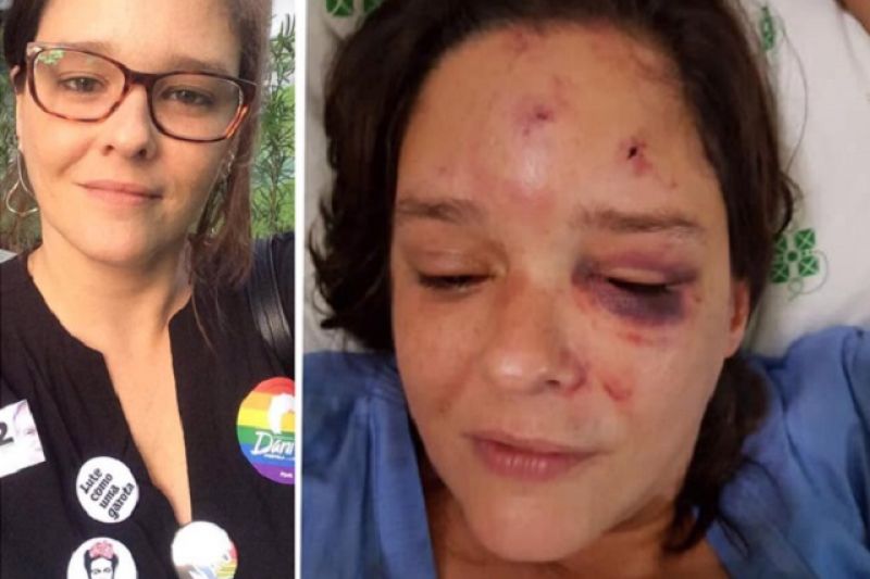 Bolsonaristas espancam servidora pública que usava adesivos de Ciro Gomes, em PE