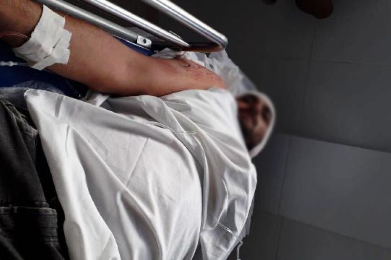 Vigilante noturno de Inhapi é atingido com tiro na cabeça em atentado na Bahia e escapa