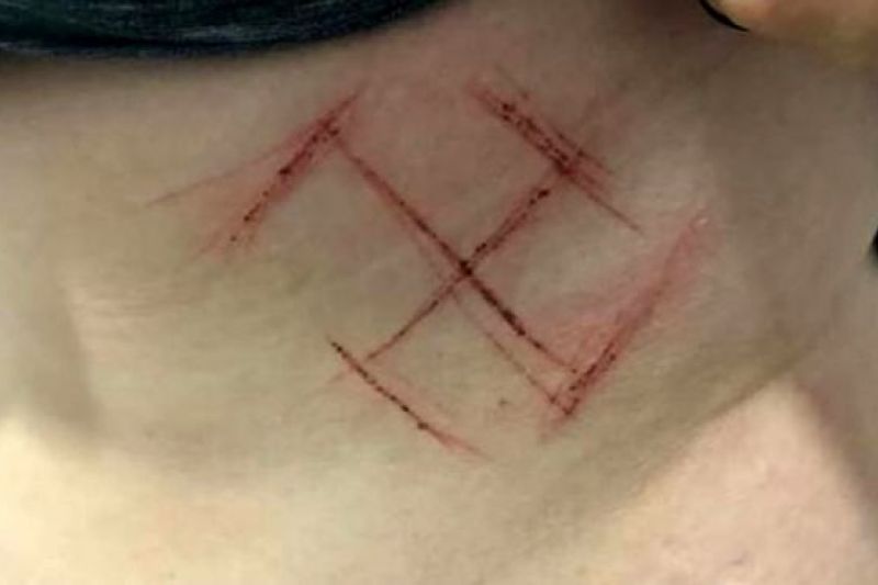 Como perícia, câmeras e testemunhas contradizem versão de jovem sobre suástica