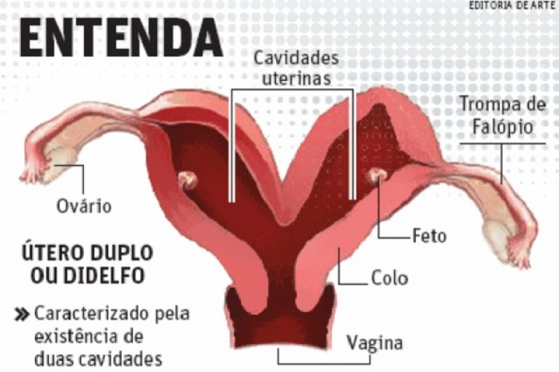A mulher com dois úteros que deu à luz gêmeos um mês após ter tido outro bebê