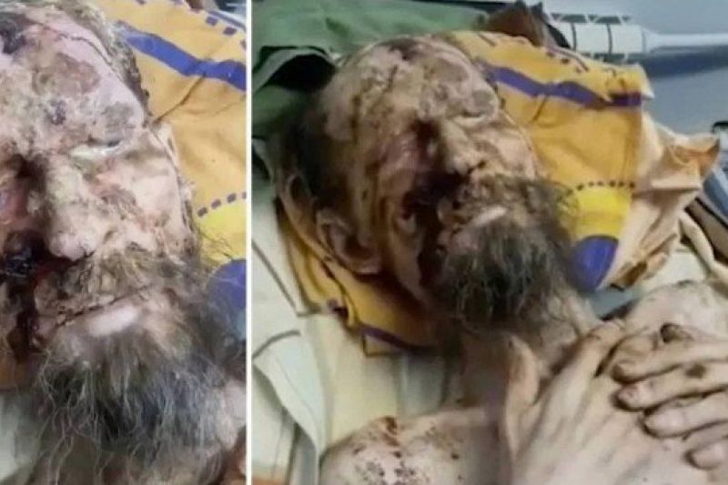 Russo é achado vivo e 'mumificado' após um mês mantido 'refém' de urso