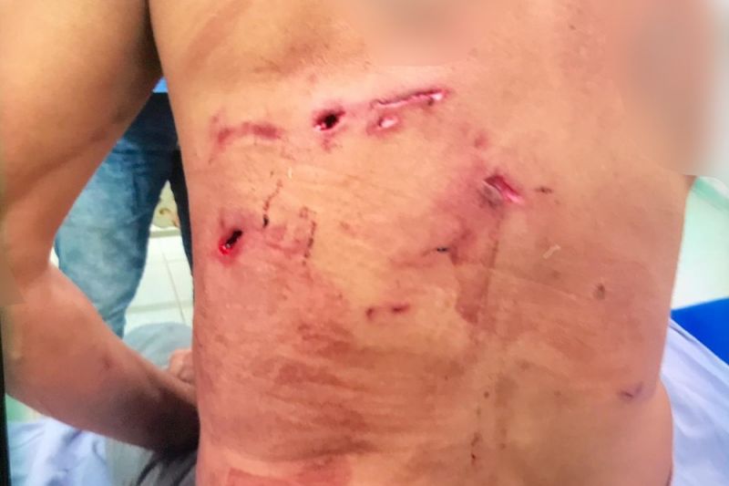 Homem atacado por onça-pintada é salvo por 5 cachorros em MS