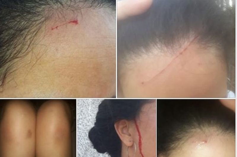 Mulher relata ataques de gavião toda vez que sai de casa: 'Não posso abaixar a cabeça'