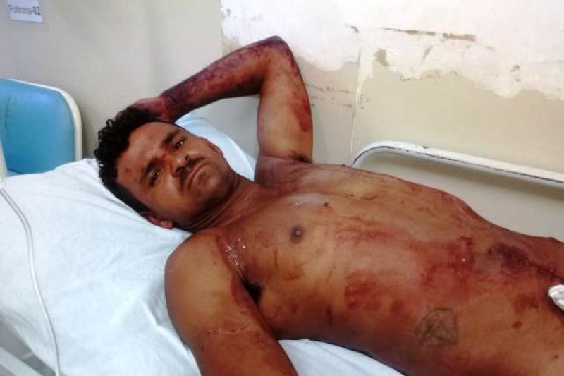 Foragido da Justiça preso em Paulo Afonso quase perdeu o pênis tentando escapar da polícia