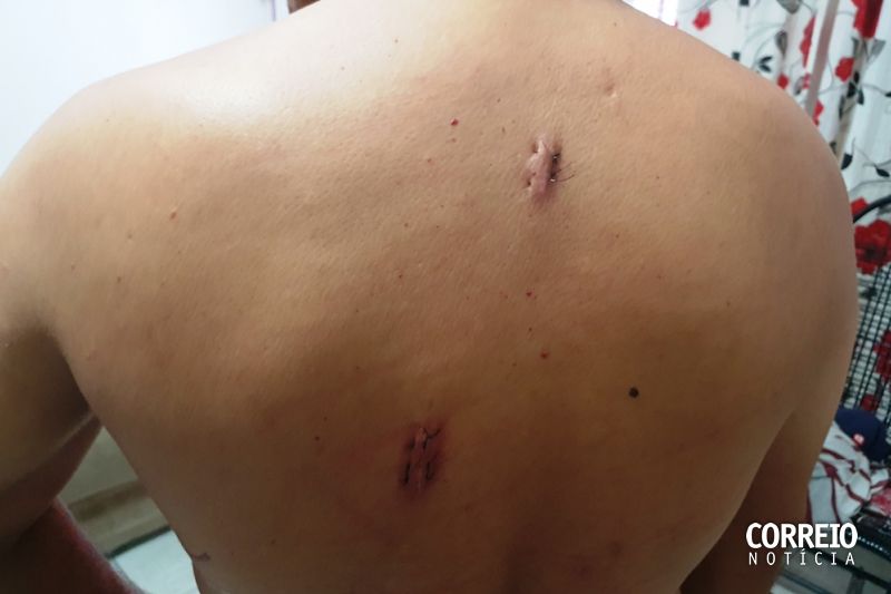 Sobrevivente de atentado que deixou dois irmãos mortos conta detalhes sobre o crime