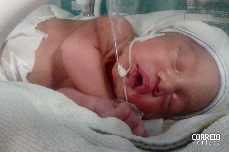 Bebê gerado fora do útero da mãe, que é de Monteirópolis, nasce em maternidade de Maceió