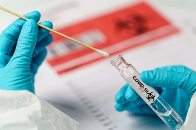 Prefeitura de Delmiro firma contrato de R$ 60 mil para realização de exames de Covid-19