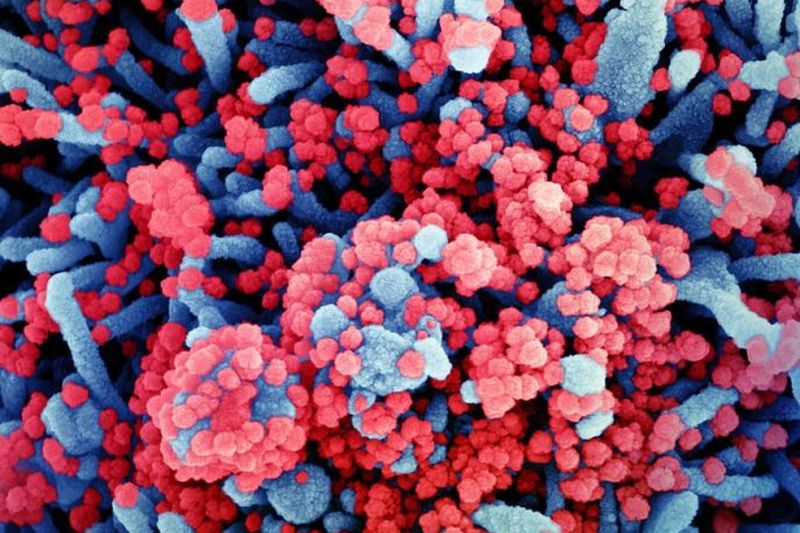 Minas confirma casos de crianças com Síndrome Multissistêmica provocada por Covid-19