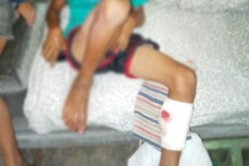 Atentado à bala deixa três meninos da mesma família feridos em Senador Rui Palmeira