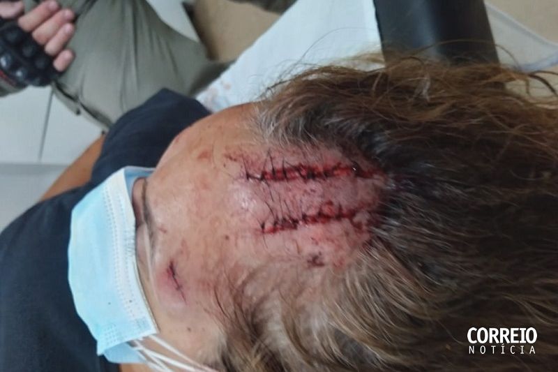 Advogado é suspeito de tentar matar irmã e sobrinho com barra de ferro em Delmiro Gouveia