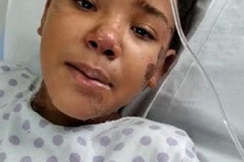 Morre menina de 10 anos vítima de explosão de celular em povoado de Pão de Açúcar