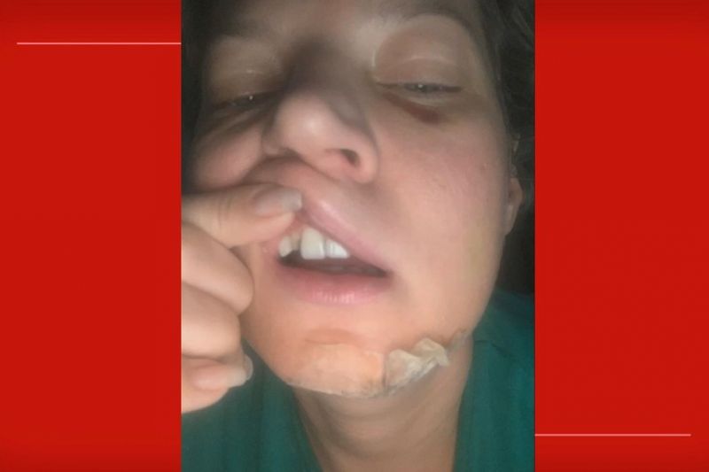 Joice Hasselmann: polícia do DF descarta agressão e diz que deputada caiu