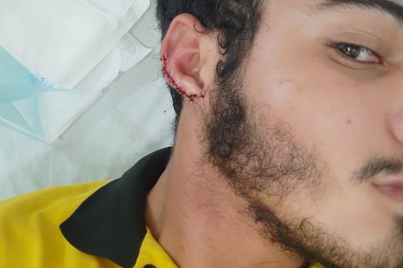 Impedido de comprar fiado, homem arranca na dentada parte de orelha de chapeiro em Tapera
