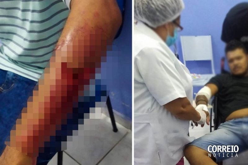 Briga em frente de casa de shows termina com duas pessoas esfaqueadas em Inhapi