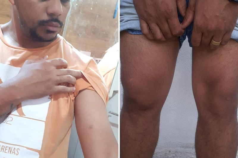 Ex-jogador Cleiton Xavier e amigos são suspeitos de espancarem casal embriagado em Tapera