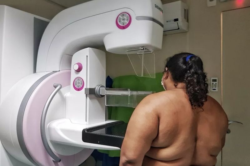 Delmiro Gouveia realiza mutirão de mamografias até a próxima quinta-feira (10)