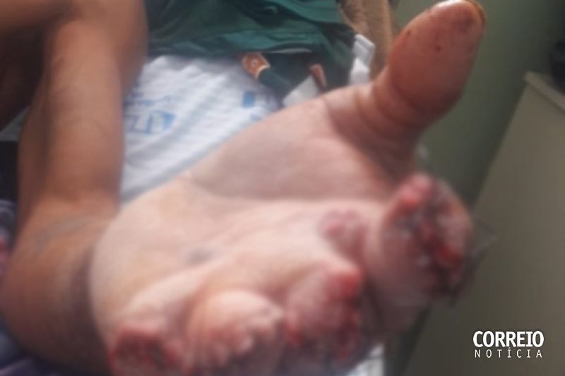 “Gato” de água encontrado na casa do suspeito motivou atentado à bala em Mata Grande