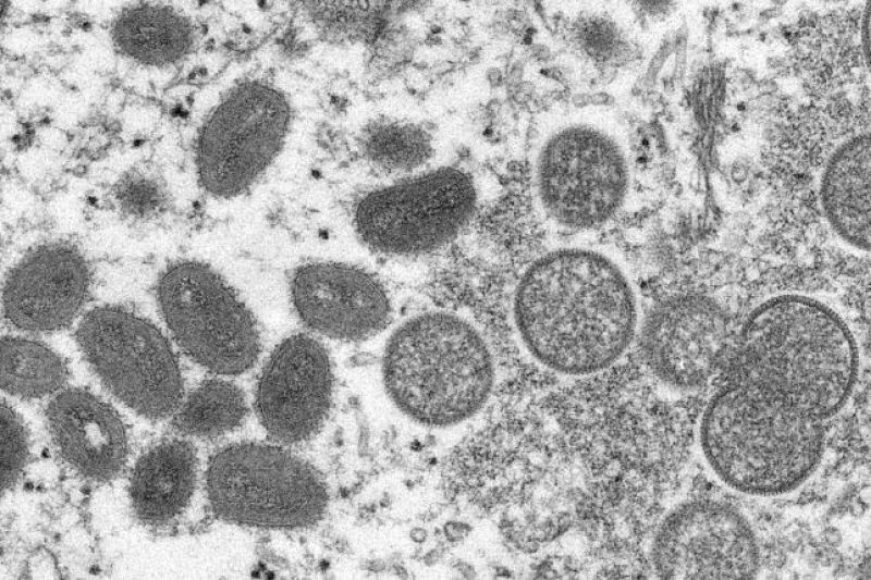 Varíola dos macacos: veja lista de sintomas e como se proteger