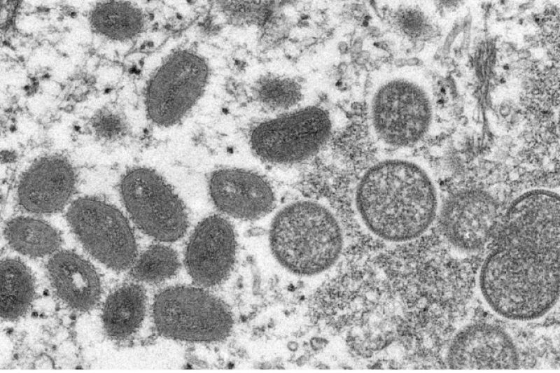 Anvisa analisa antiviral para tratar varíola dos macacos