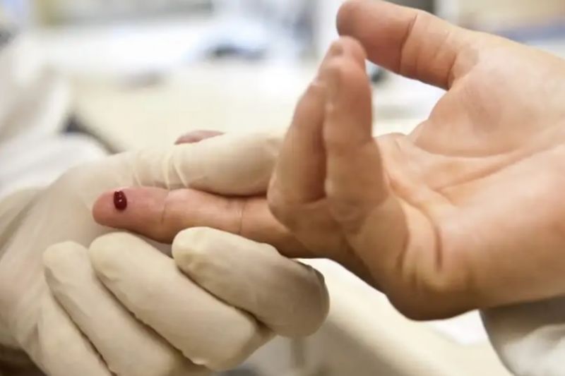 Casos de sífilis e de HIV/aids aumentam entre homens jovens