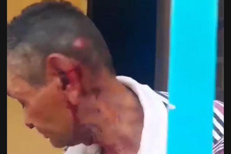 Assaltante foge com dinheiro e bebidas após atacar dono de bar com facadas em Mata Grande