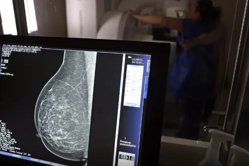 Cerca de 77 mil mulheres aguardam mamografia pelo SUS